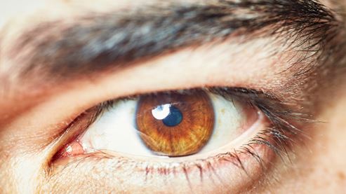 Corneal Transplant Surgery