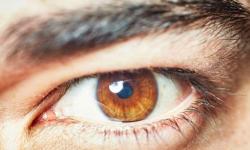 Corneal Transplant Surgery